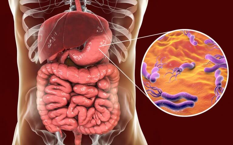 Anemia Perniciosa: Síntomas, Causas Y Tratamiento - Muy Salud