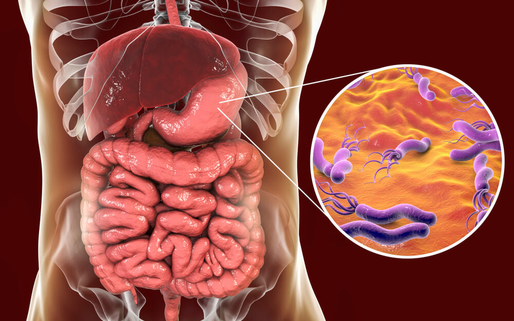 Helicobacter pylori maag gastro-intestinale infectie