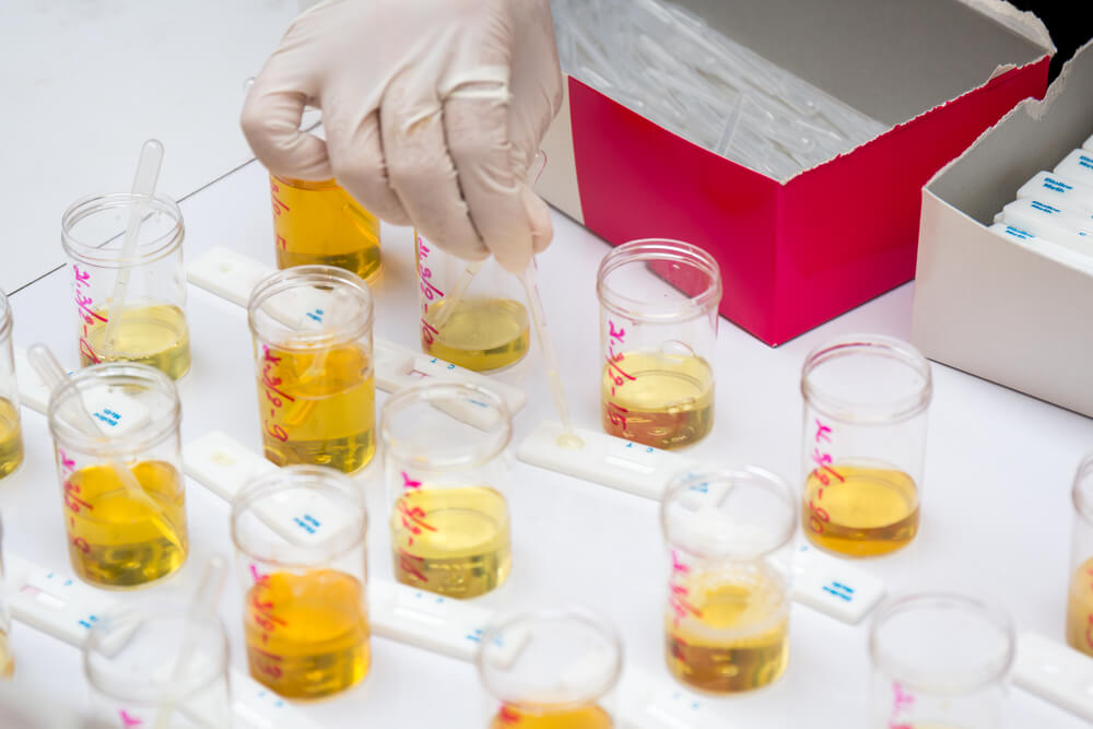 A lab technician performing urine tests.