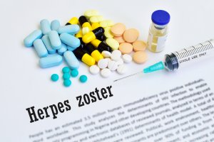 Herpes zóster: un viejo amigo