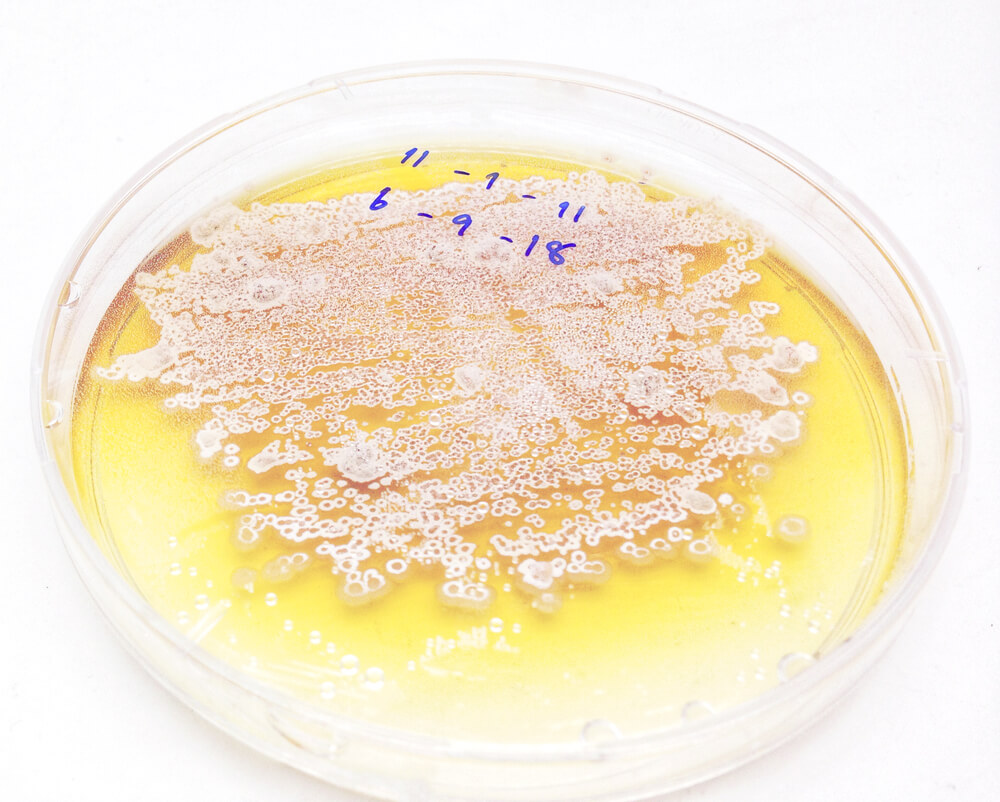 Piastra Petri di agar con coltura streptomyces
