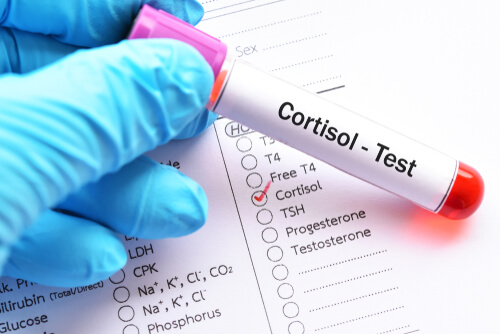 Test del cortisolo