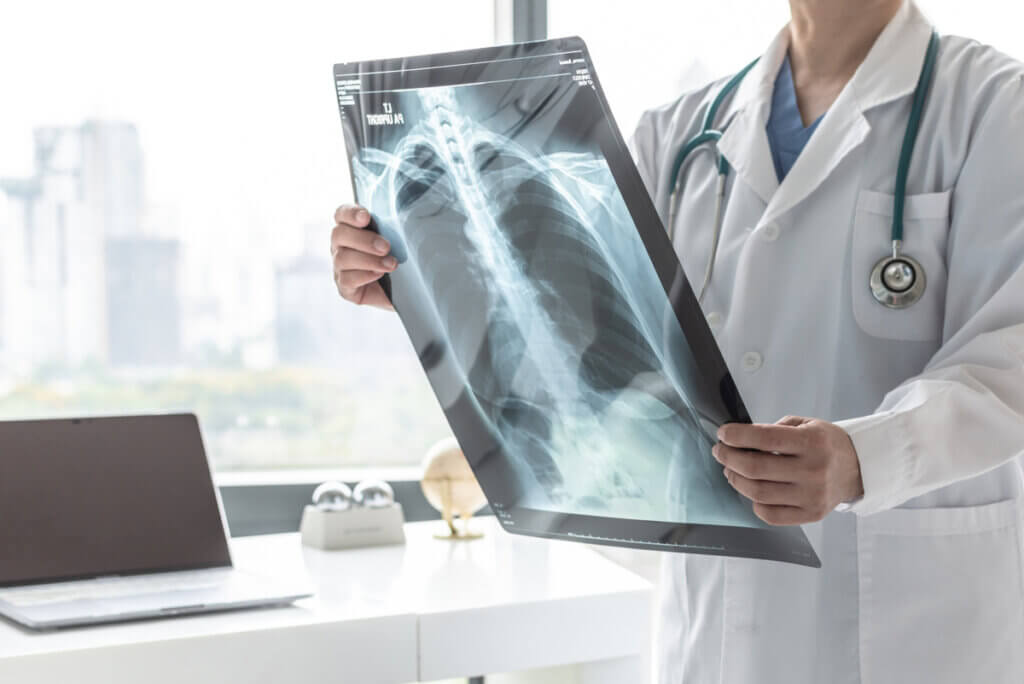 Radiographie pulmonaire lue par un médecin.