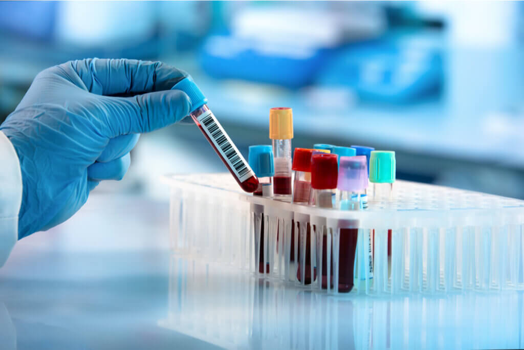 Marcadores bioquímicos