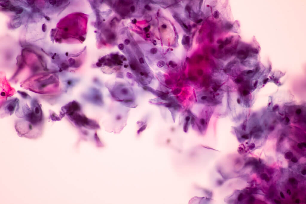 Imagen microscópica de Candida albicans.