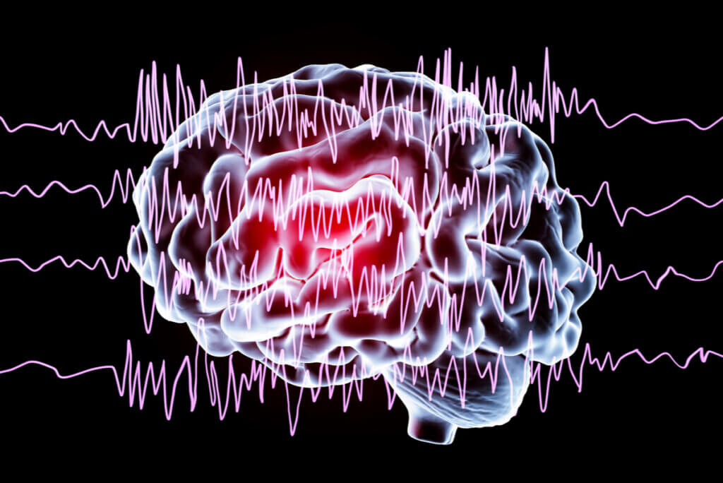 Gabapentina para la epilepsia.
