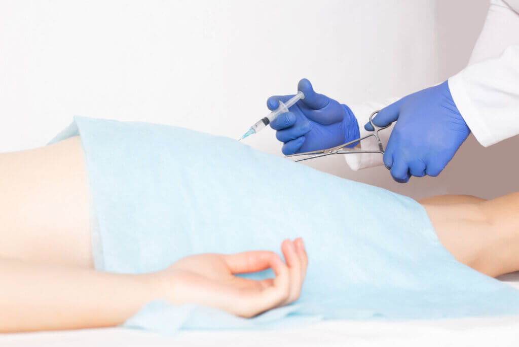 Chirurgie des hémorroïdes.