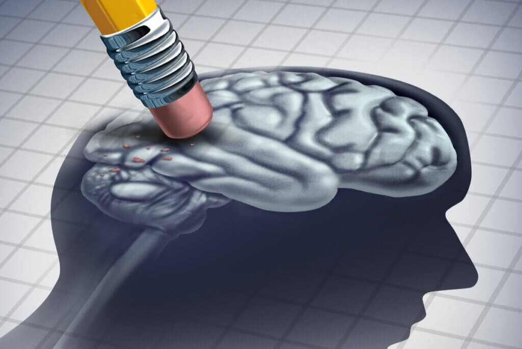 Pérdida de neuronas en la enfermedad de Huntington.