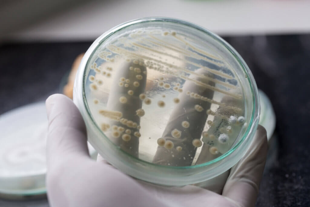 Vaginosis bacteriana.