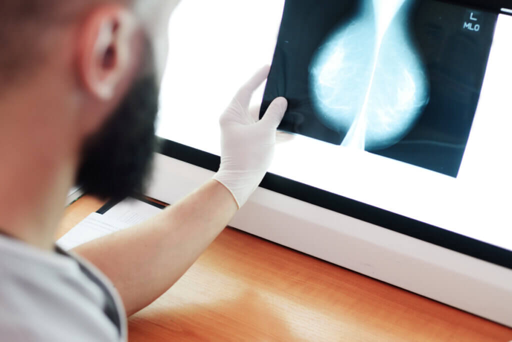Un médecin lit une mammographie.