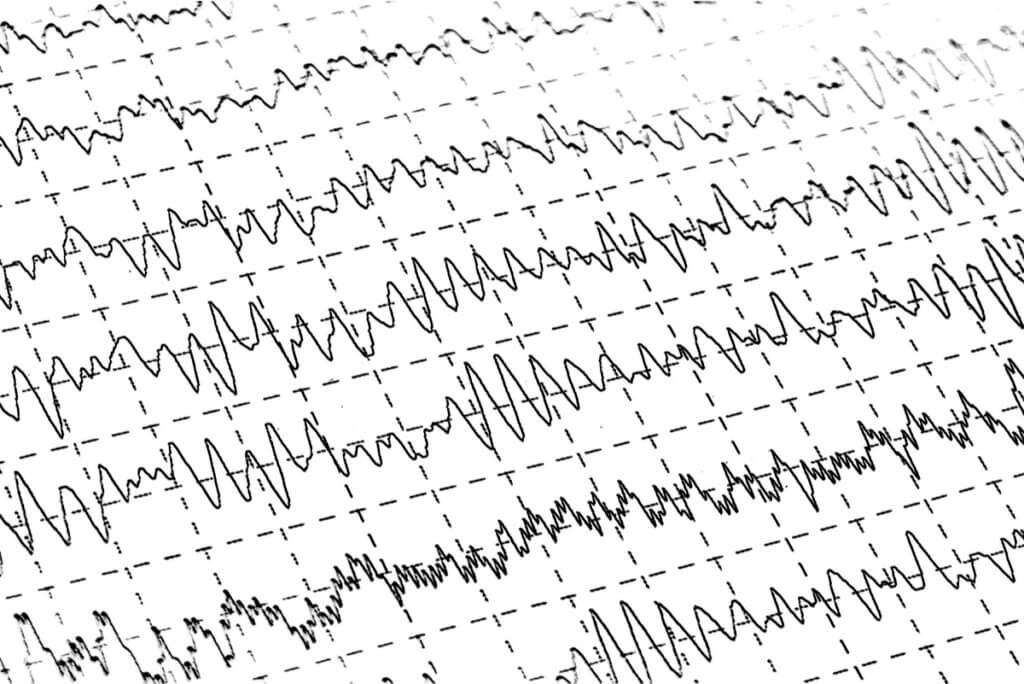 Electroencephalogram during sleep.