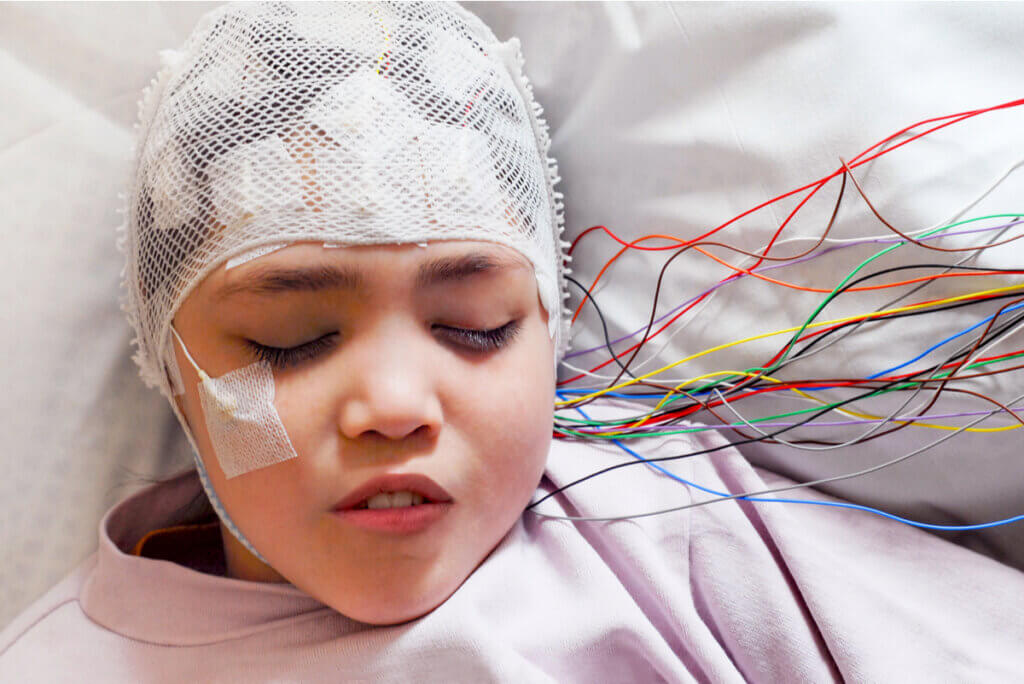 Eletroencefalograma em uma menina.