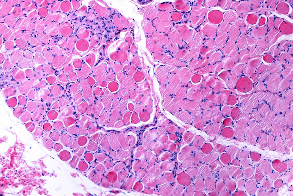 Tejido muscular en microscopio.