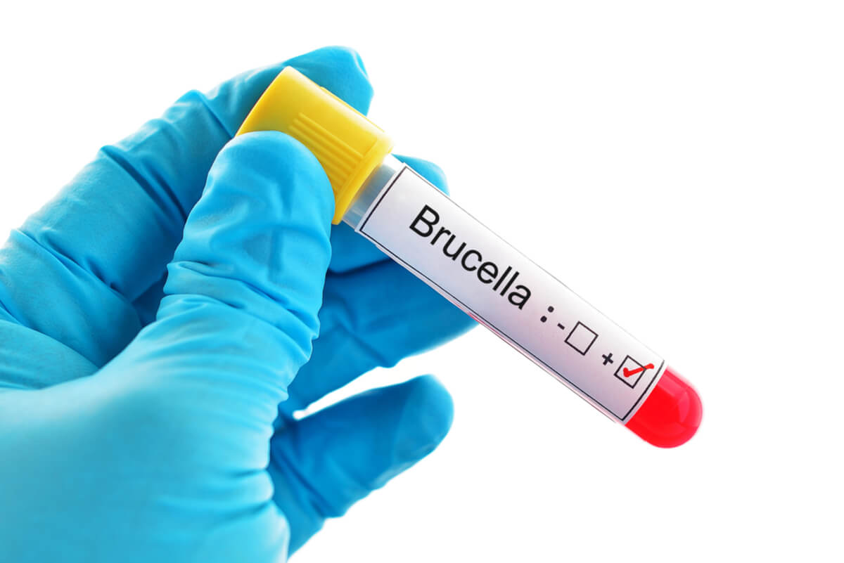 Brucelosis: síntomas, causas y tratamiento
