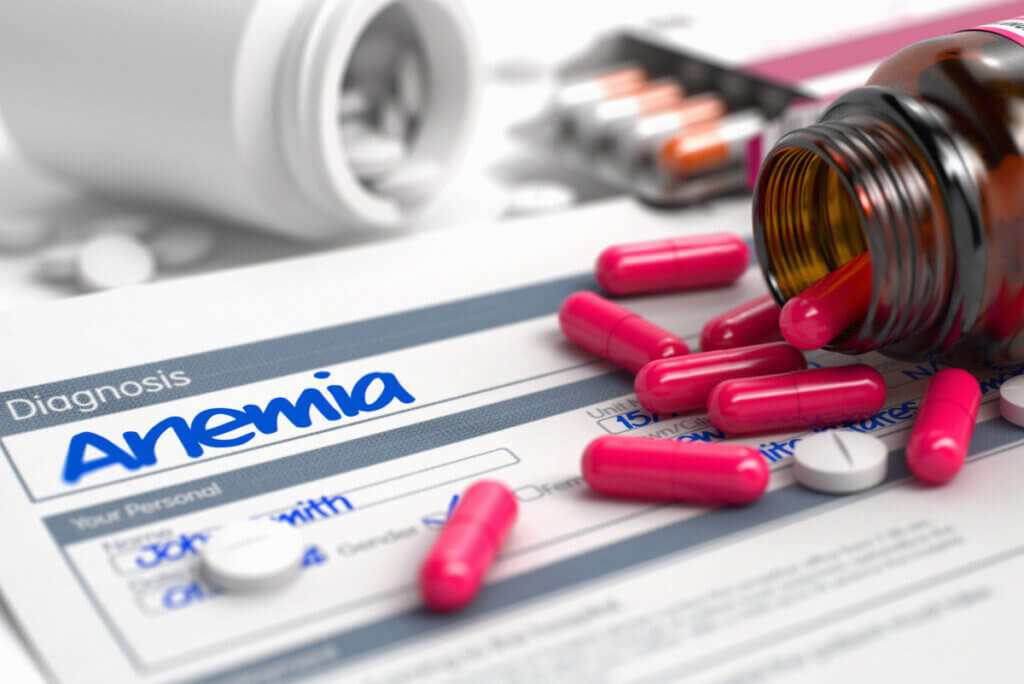 Anemia y suplementos de hierro.
