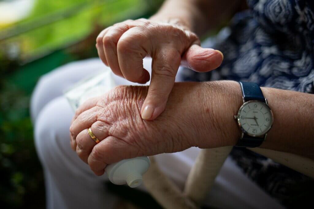 Dolor articular por artritis reumatoide.