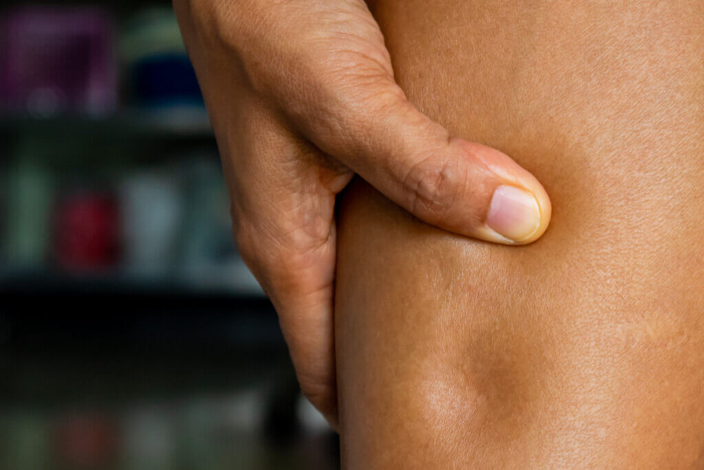 Signo de la fóvea en los edemas.