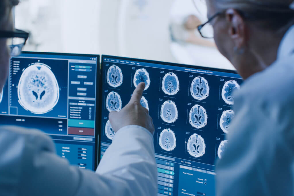 Tomografía para el diagnóstico de derrame cerebral.