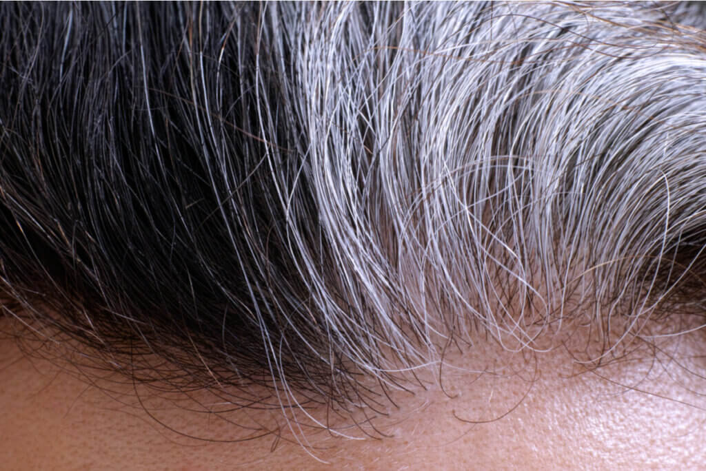 Canas en un cuero cabelludo.