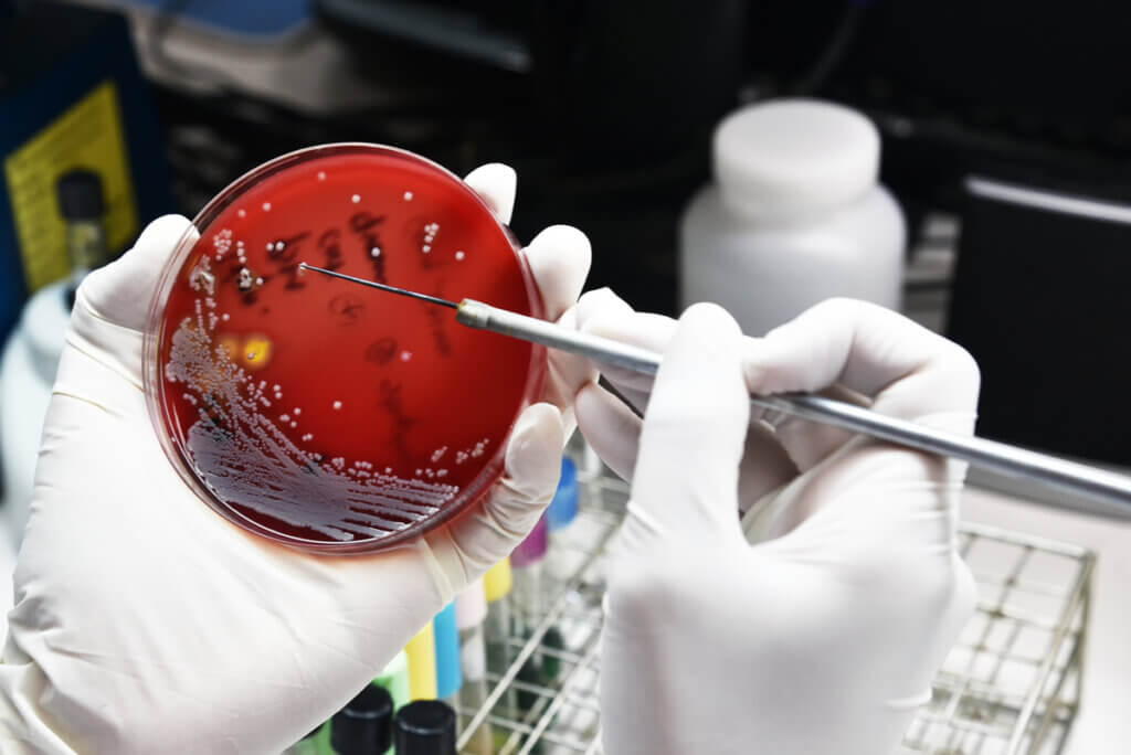 A culture of drug-resistant bacteria.