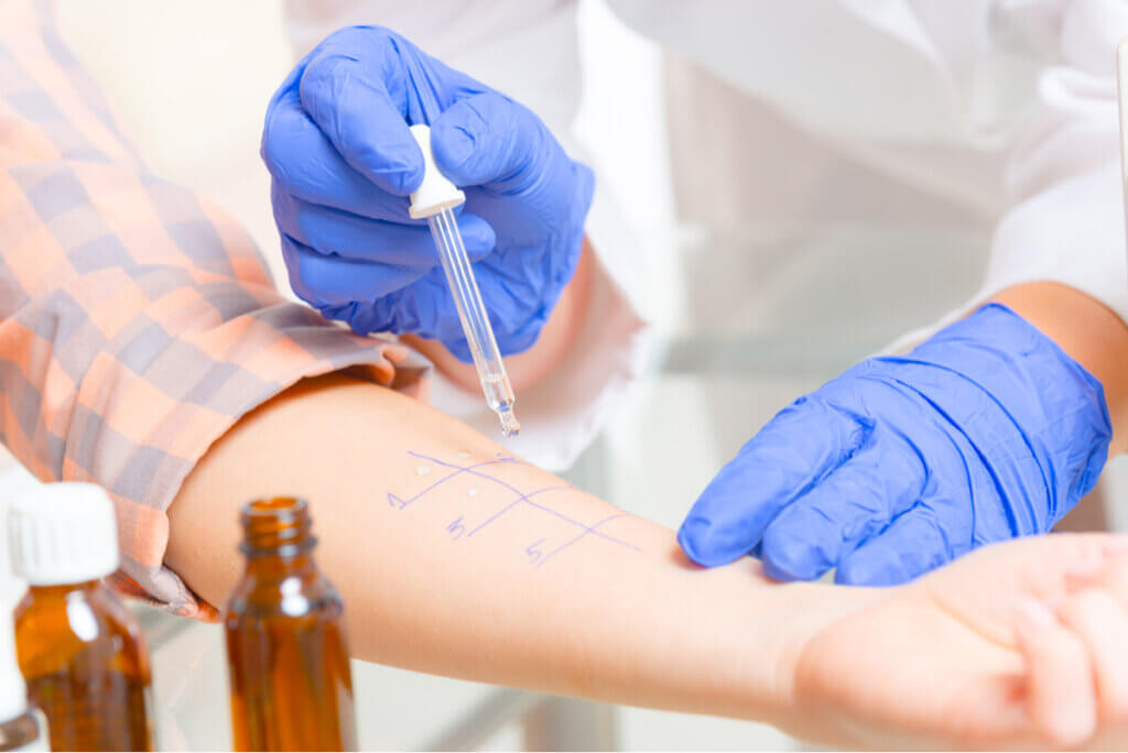 Prueba de alergia cutánea.
