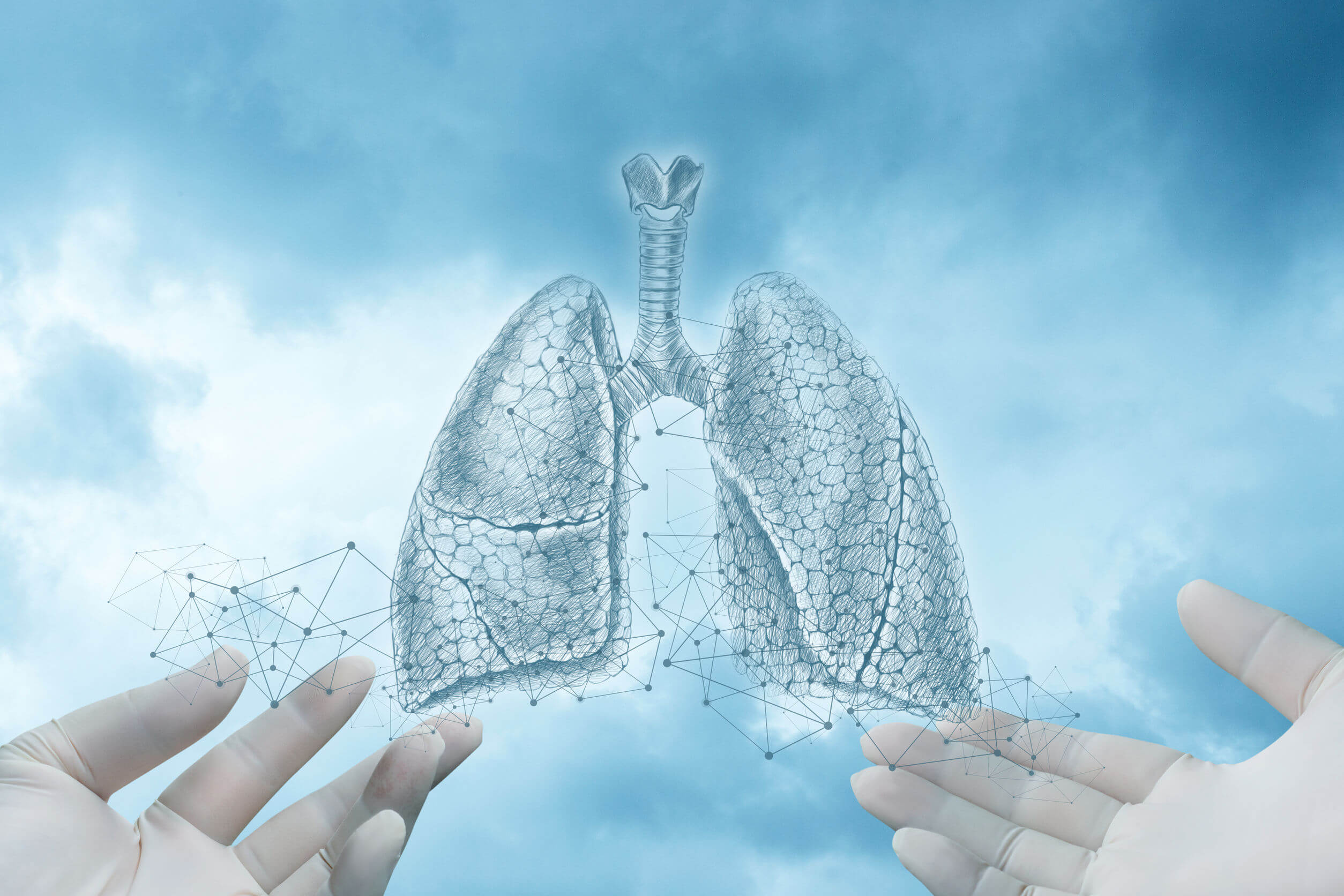 O pneumotórax é uma doença do sistema respiratório.