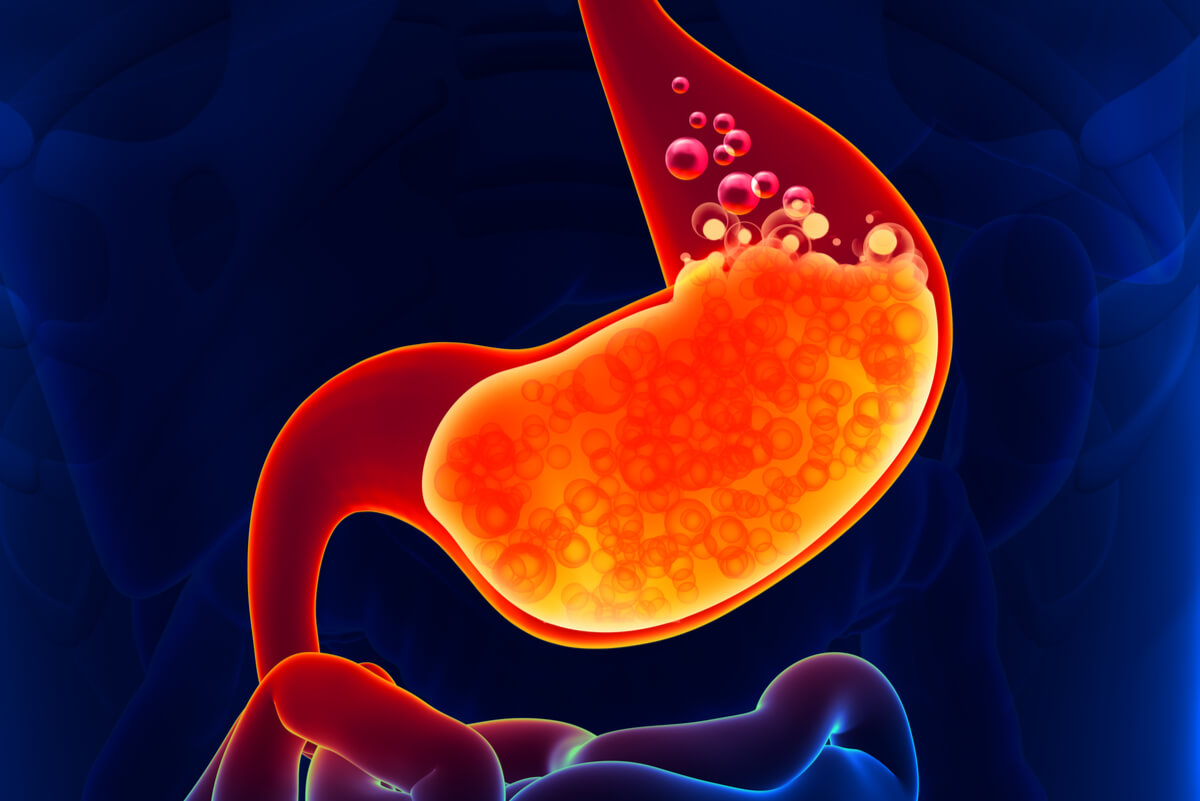 La hiperemesis gravídica puede ocasionar reflujo.
