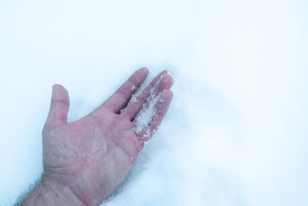 Mano con hipotermia en la nieve.