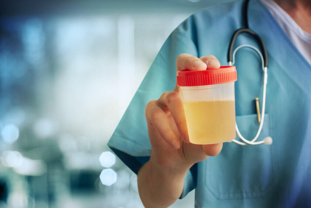 Análisis de orina para la diabetes insípida nefrogénica.