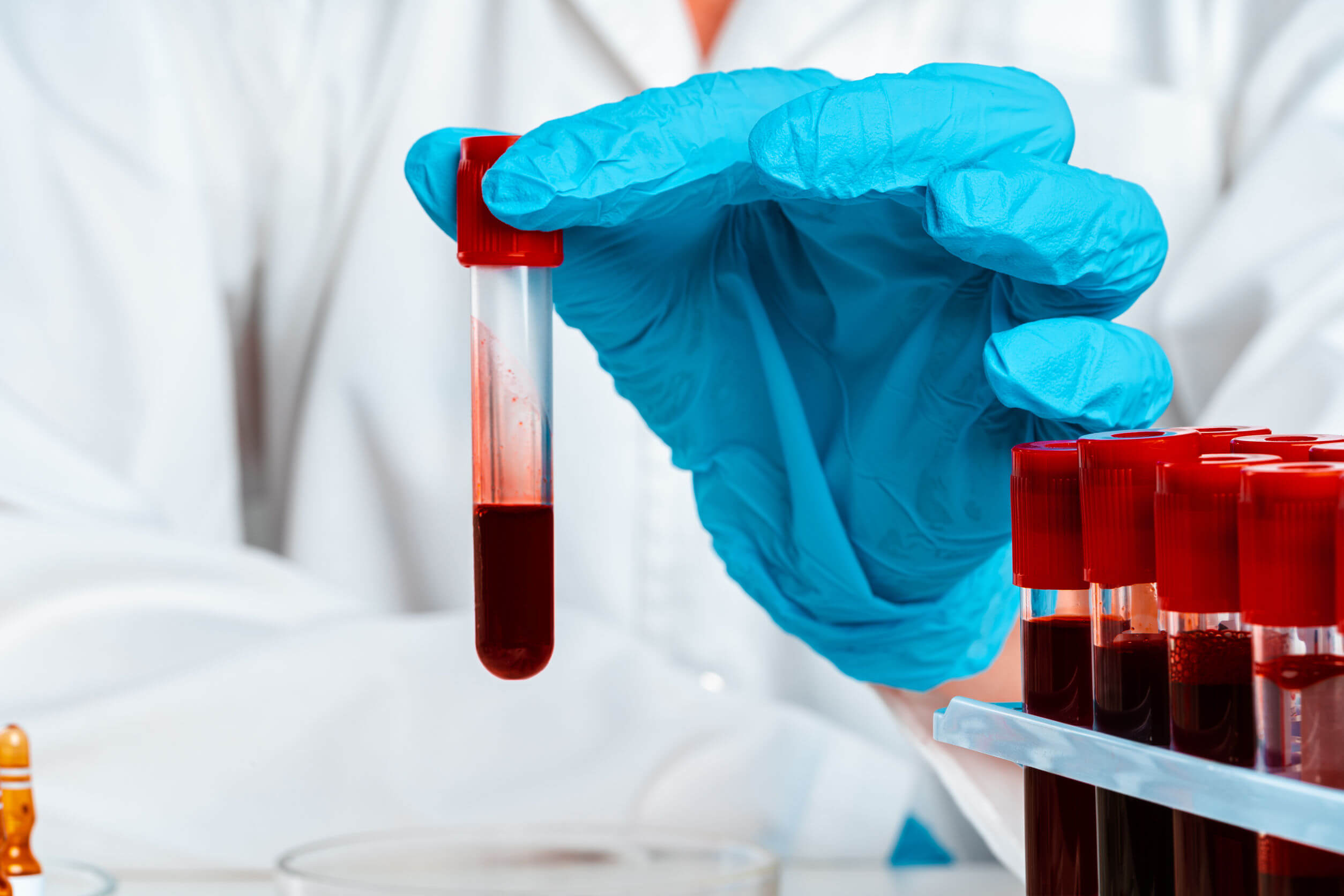 Las enfermedades comunes en hombres también afectan la sangre.