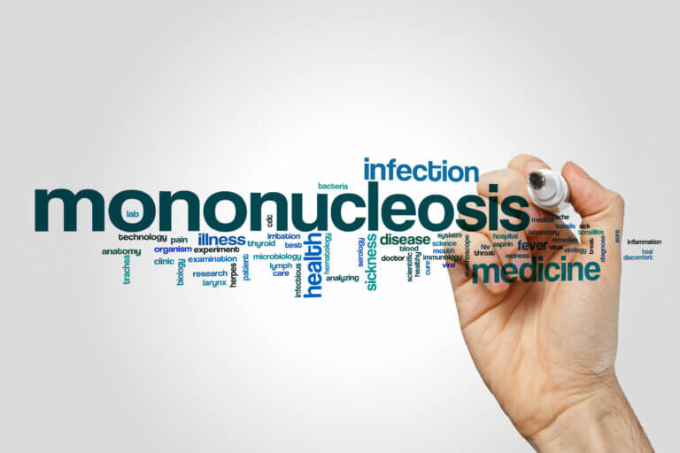 Mononucleosis: síntomas, causas, diagnóstico y tratamiento