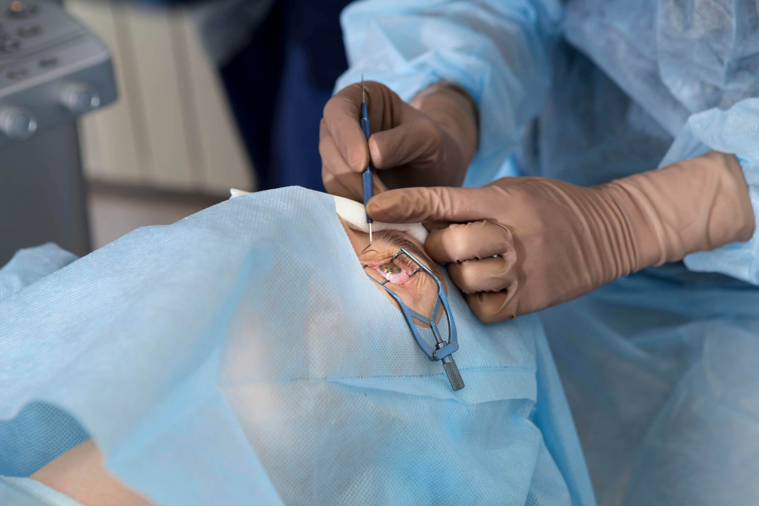 Trattamento chirurgico del glaucoma