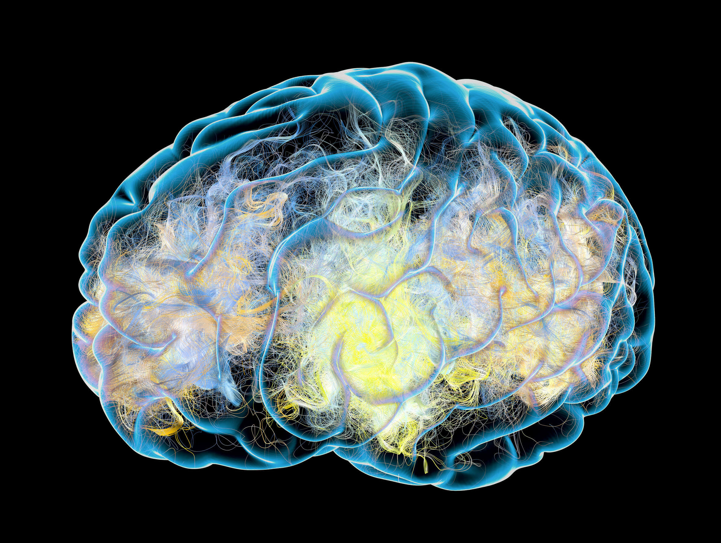 Il senso dell'umorismo cambia il cervello in modo positivo.