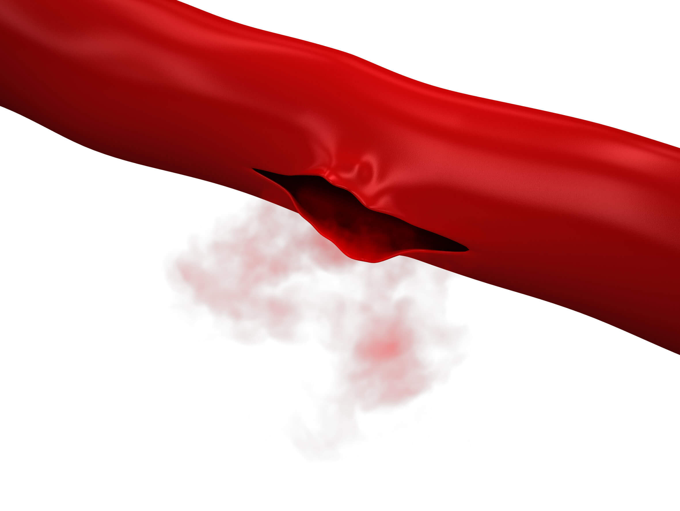 As doenças genéticas são comuns.