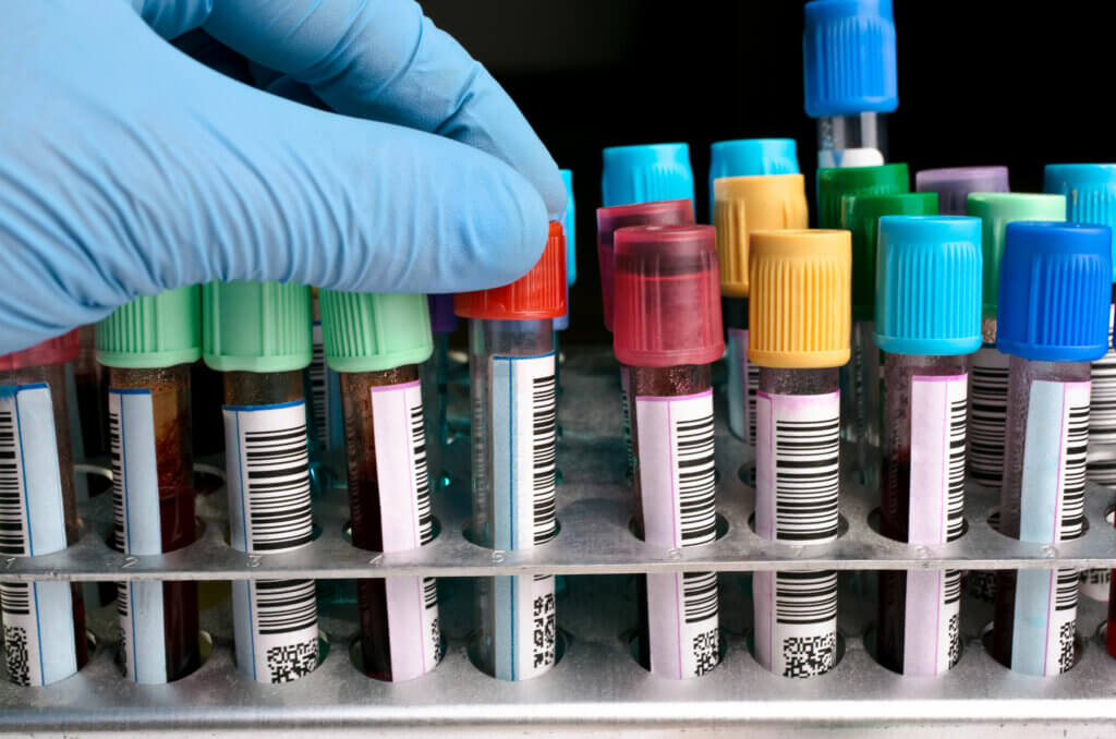 Blood Tests: Understanding Their Use