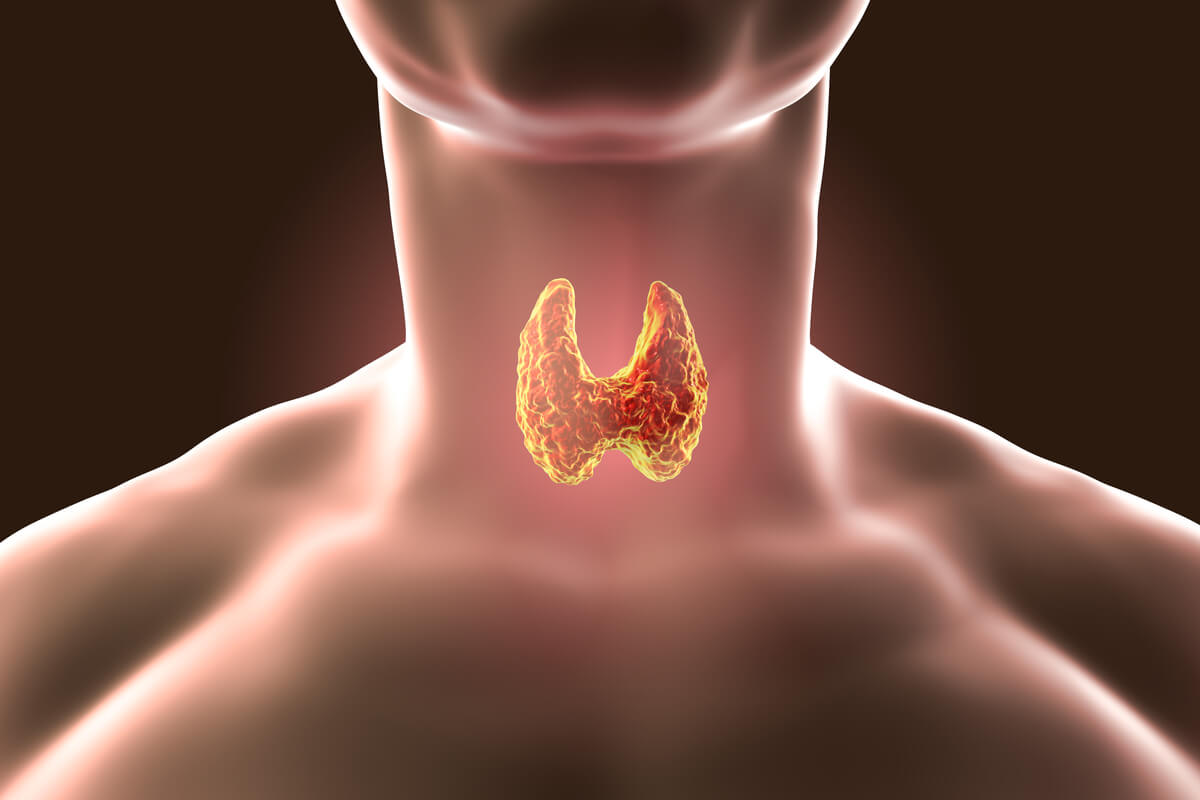 La enfermedad de Hashimoto afecta a la tiroides.