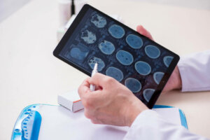 Amygdala: Structure, Characteristics and Functions