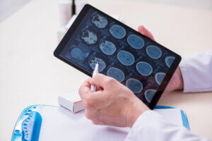 Amígdala: estructura, características y funciones