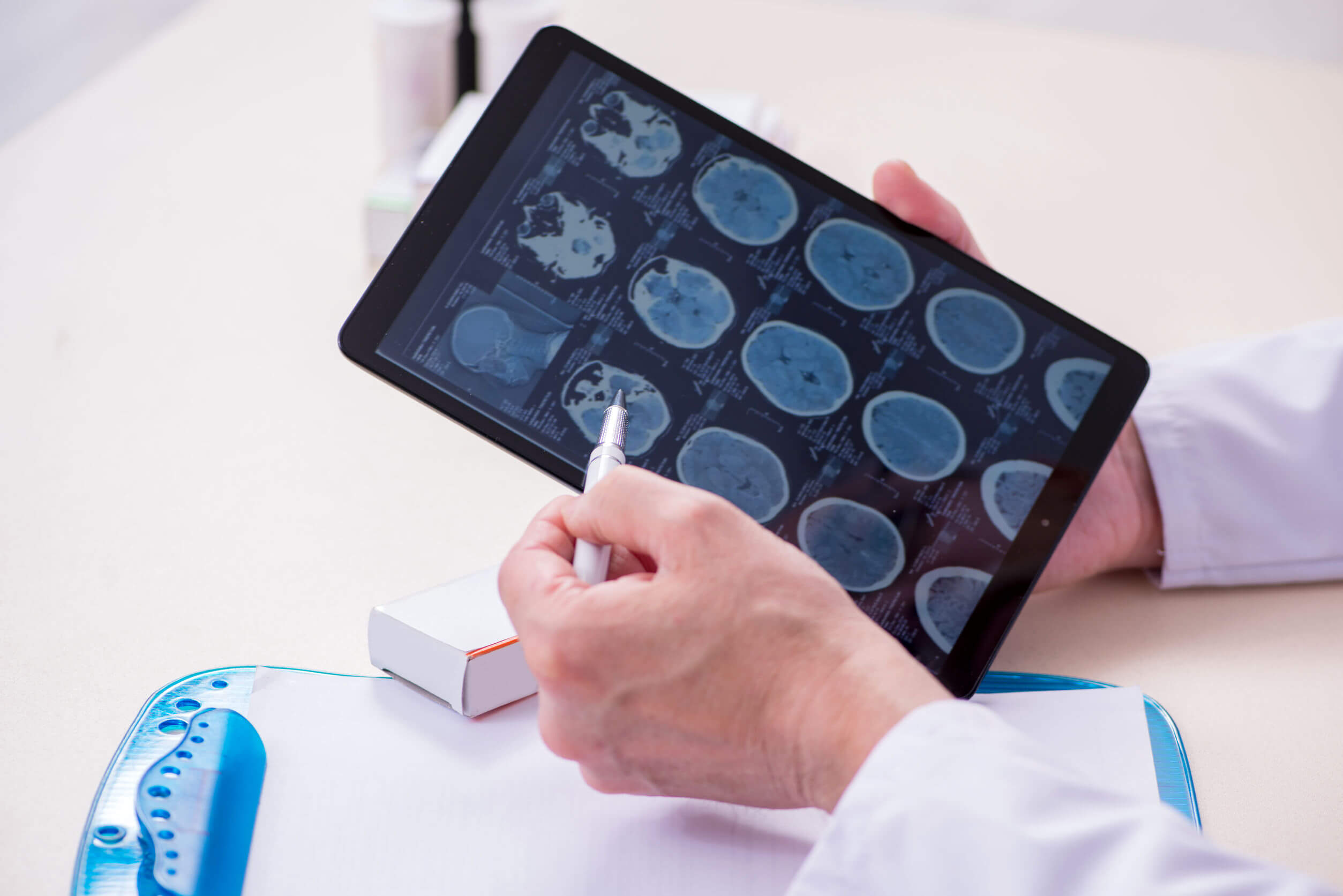 La mydriase a un diagnostic complexe