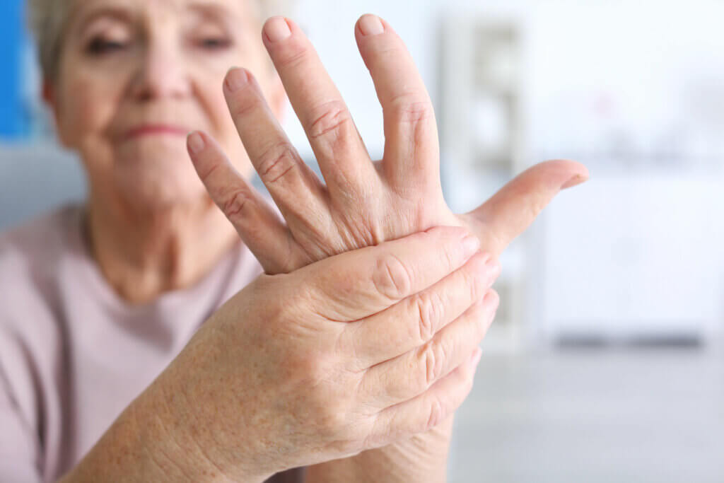Woman with rheumatoid arthritis.