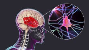 Lóbulo temporal: características y funciones