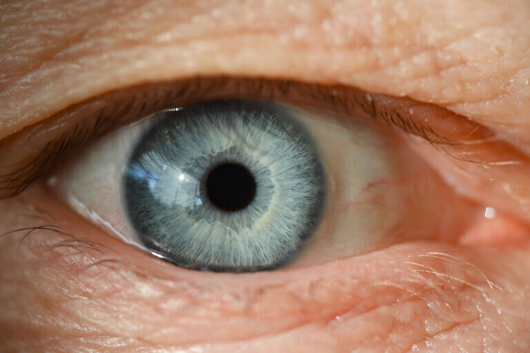 Desprendimiento de retina: síntomas, causas y tratamiento