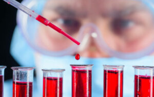 O'Sullivan's Test: What Does it Consist Of?