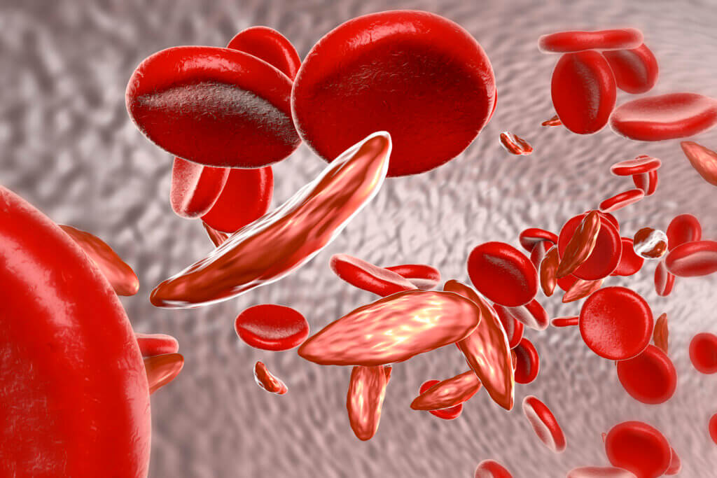 Causas de la anemia