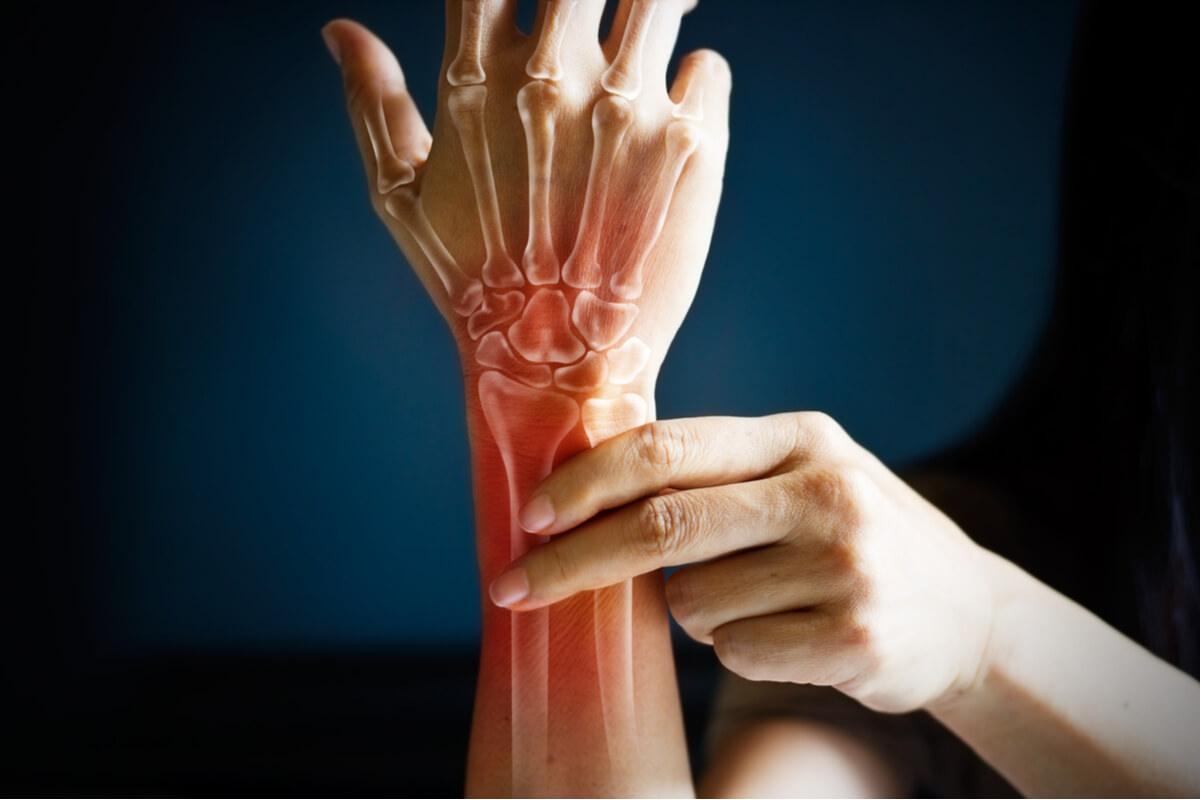 I segni e i sintomi della clamidia includono l'artrite
