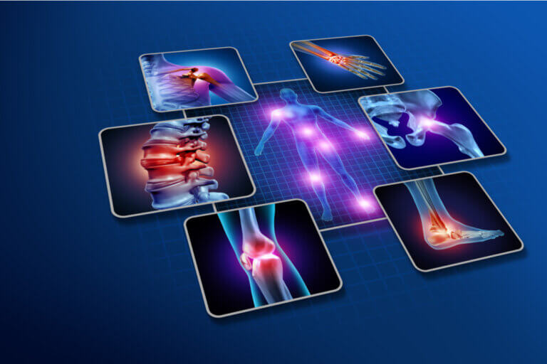 Causas y factores de riesgo de la artritis reumatoide