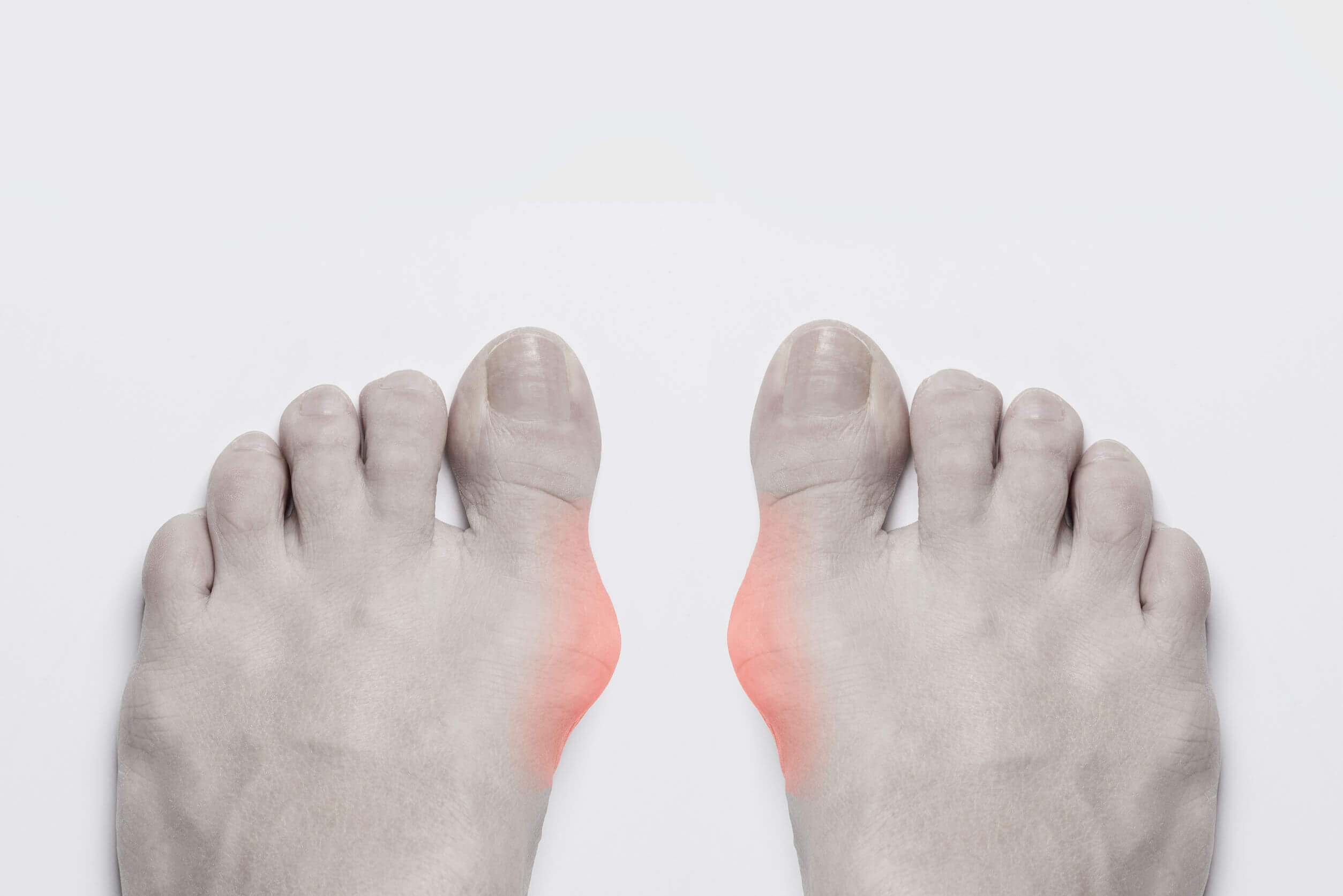 Patients with gout should exercise caution while taking indapamide.