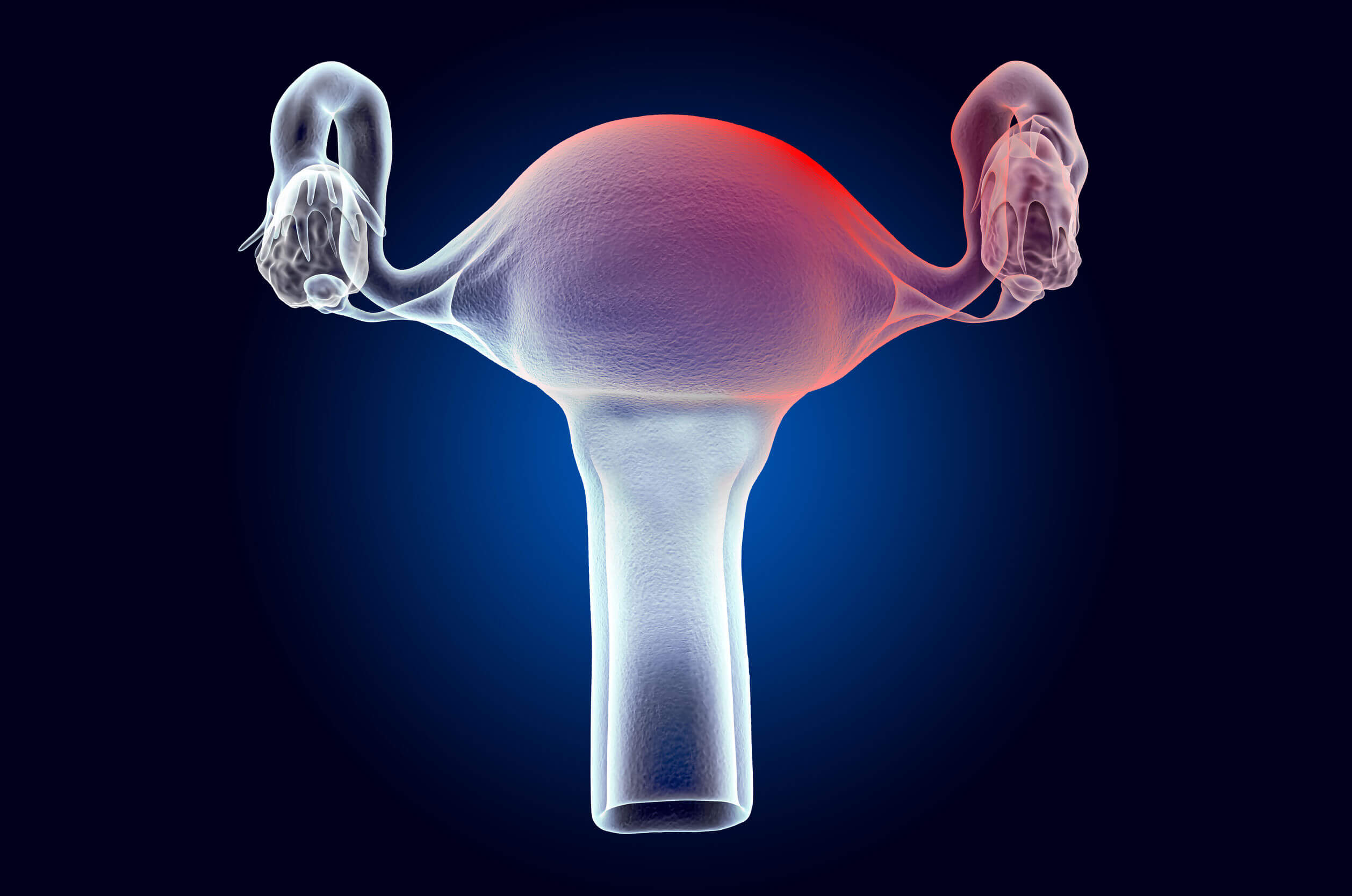 Miomas uterinos: síntomas, causas y tratamiento