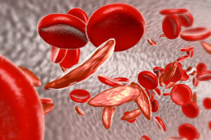 Causas da anemia