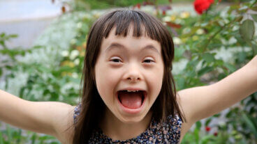 Síntomas del síndrome de Down